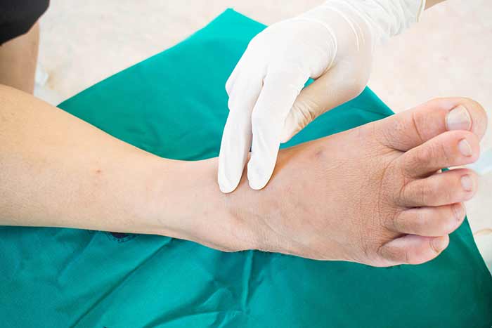 معاینه پا توسط پزشک
