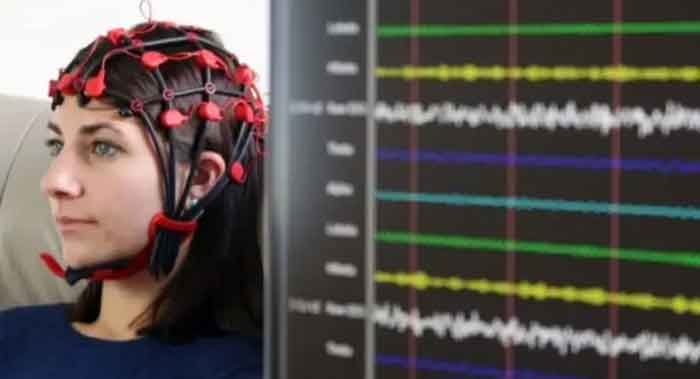 نقشه مغزی اختلال دوقطبی