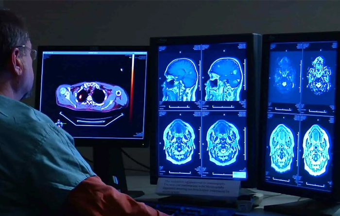 ویژگی های امواج مغز در افراد افسرده