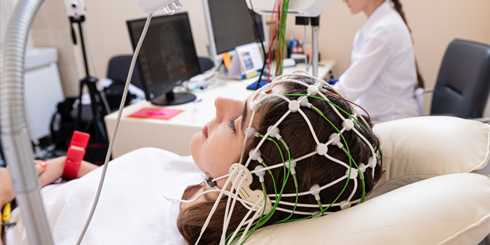 نوار مغز (EEG)