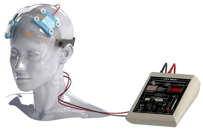 دستگاه tdcs