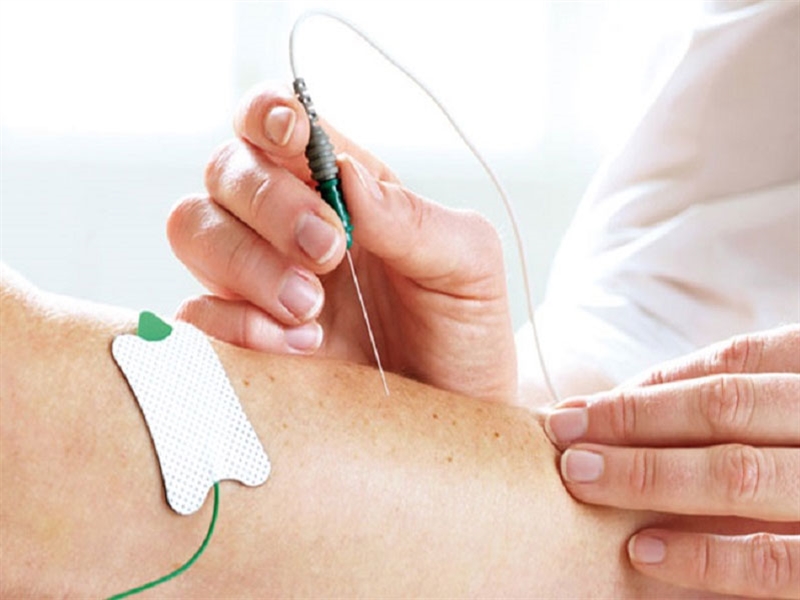 نوار عصب و عضله (EMG) چیست؟ و برای چه انجام میشود؟